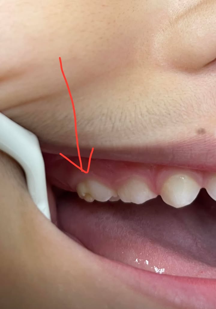 איפה מתחבאים הפגמים?