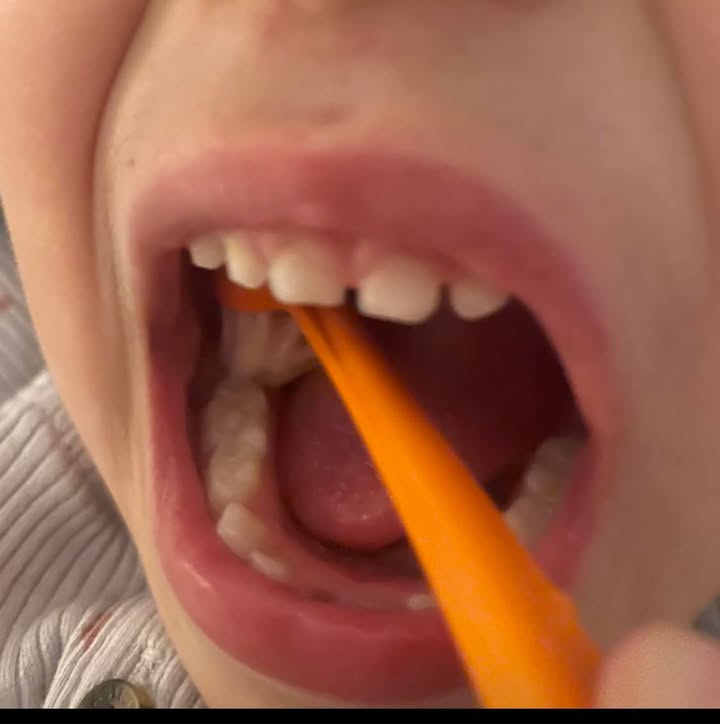 ילד עם רפלקס הקאה בצילום