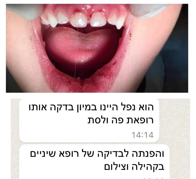 חבלה בשן: מיון או מרפאה?